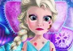 Elsa Karlar Ülkesi yaralı