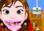 Ledové království Anna péče o zuby