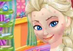 Elsa einfache Verjüngungskur